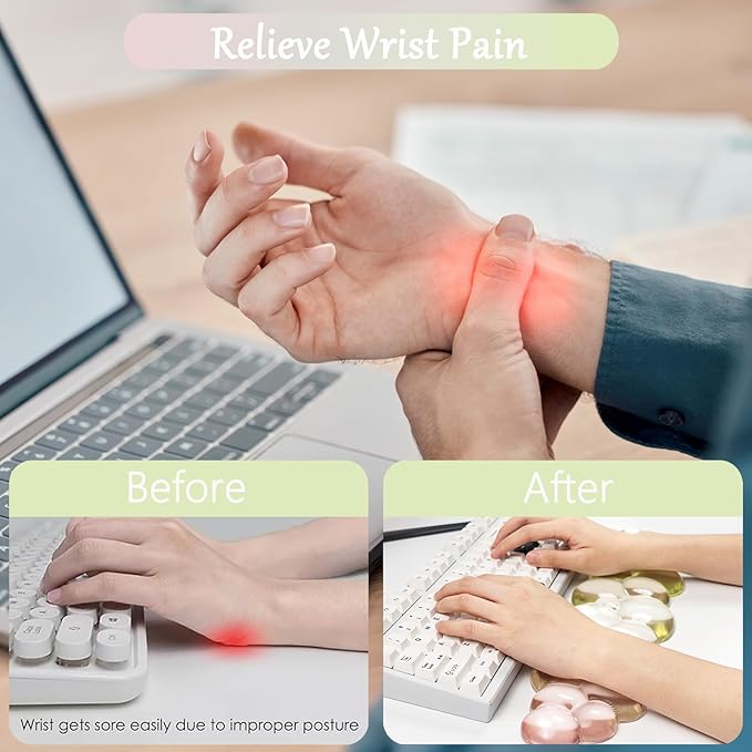 Cloud Keyboard and Mouse Wrist Rest Set Gel Keyboard Wrist Rest for Computer Transparent Ergonomic Mouse Wrist Pad Silicone Non-Slip Cute Clear Wrist Pad Support for Gaming Typing 68%/75% Yellow Pink