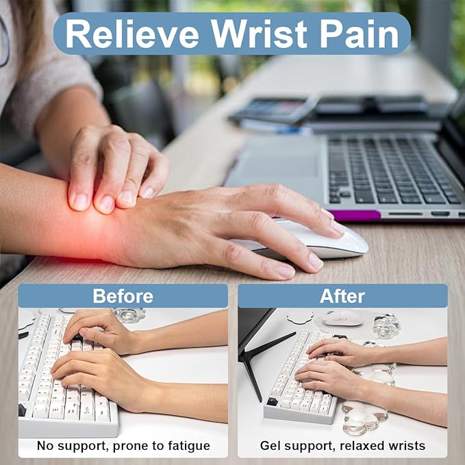 Keyboard Wrist Rest Set - Ergonomic Cloud Mouse Pad with Gel Wrist Rest Support and Cosater, Cute Office Accessories for Computer/Latop/Home/Office